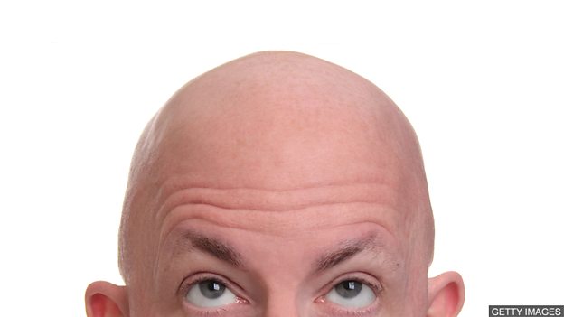 baldness 秃头的烦恼